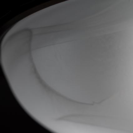 Brilagi - Plafondlamp FRESCO 2xE27/40W/230V Ø 30 cm koperkleurig