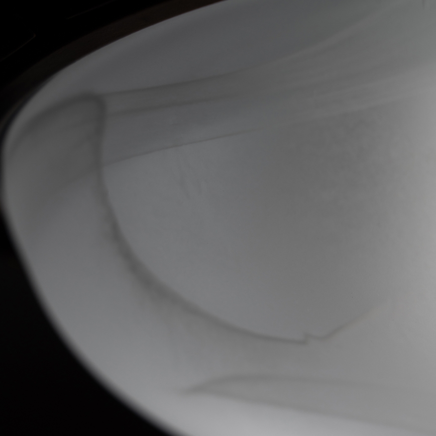 Brilagi - Plafondlamp FRESCO 2xE27/40W/230V Ø 30 cm koperkleurig